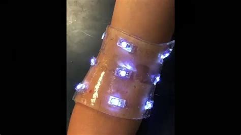 Smart Bandages -Aid On The Horizon | ProDigitalWeb