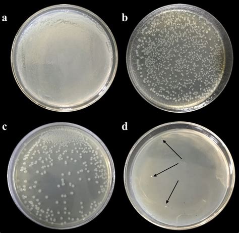 Digital image of colony-forming unit of E. coli incubated a on the... | Download Scientific Diagram