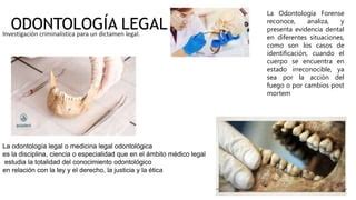 Equipo Odontolog A Legal Y Forense Pptx