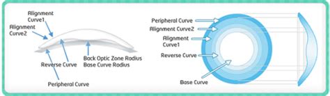 First Color Lens Order What You Must Know Solution Lens