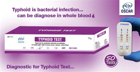 Typhoid Igm Igg Test At Best Price In Pune Maharashtra Queen Group