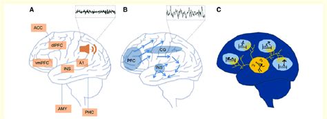 Topographic Overlap Of Brain Areas Involved In Tinnitus And Nrem Sleep