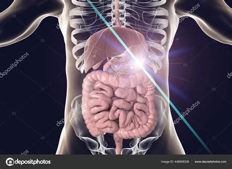 Stomach Cancer Treatment Prevention Concept Illustration Stock Photo by ...