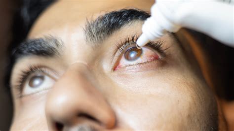 Amid Recalls, Are Eye Drops Safe to Use? - The New York Times