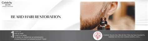 Best Beard Transplant in Hyderabad, Kakinada, & Vijayawada