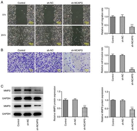 Downregulation Of NCAPG Inhibits The Migration And Invasion Of TNBC