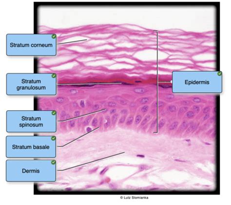 Label The Photomicrograph Of Thick Skin Quizlet Solved Label The Photomicrograph Of Thin Skin