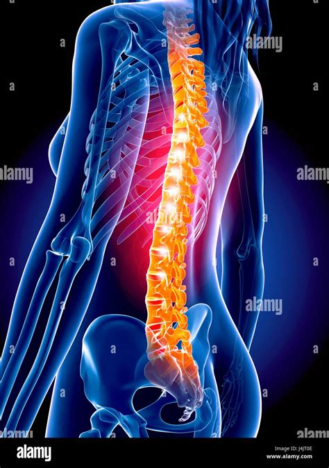 Human Spine Illustration Stock Photo Alamy