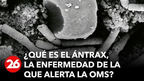 Qué es el ántrax la enfermedad de la que alerta la OMS Estos son sus