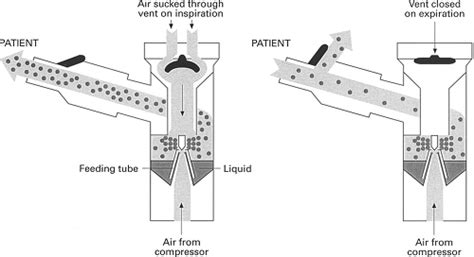 Delivery Devices for Inhaled Medications | Oncohema Key