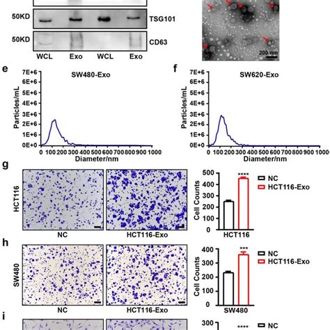 Exosomes Derived From Crc Cells Promote The Migration Of Crc Cells And