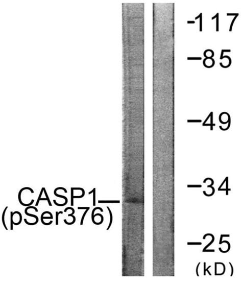 Phospho Caspase Ser Polyclonal Antibody Invitrogen G