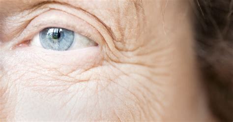 Second Skin Developed To Get Rid Of Wrinkles Researchers Time