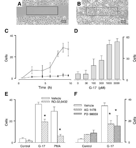 Figure 1 From Stimulation Of Gastrin Cckb Receptor Promotes Migration Of Gastric Ags Cells Via