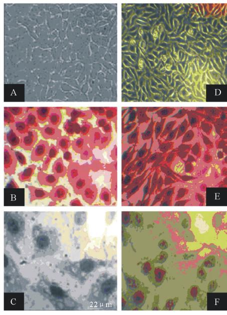 Light microscope image of (A) non stained HeLa cell culture as a... | Download Scientific Diagram