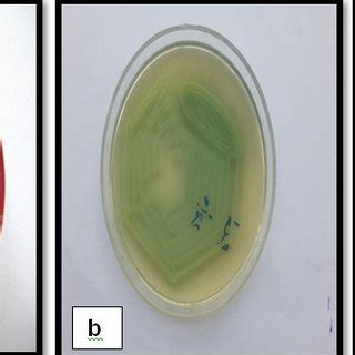 Growth Of Klebsiella Pneumoniae Species On Culture Media A Blood