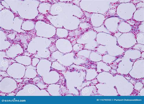 Human Lung Tissue Under Microscope View For Education Histology Stock