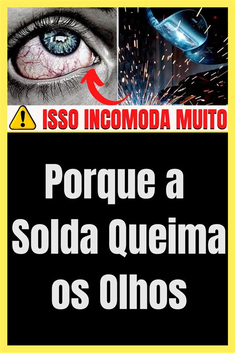 Queimadura Nos Olhos Solda RETOEDU