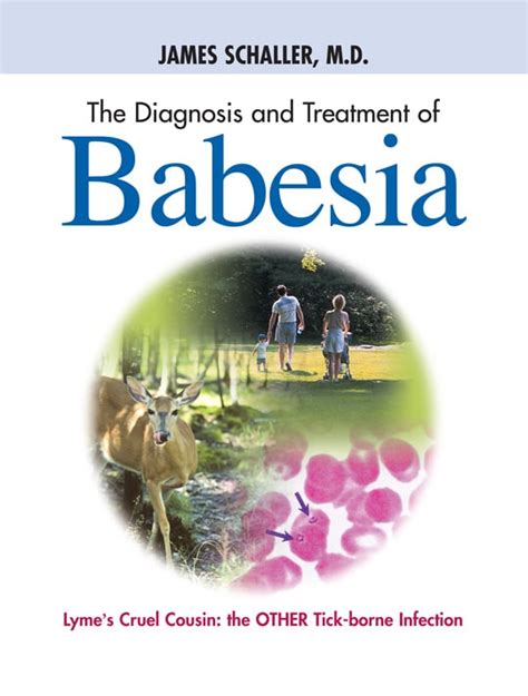 Top Book On Babesia Diagnosis Treatment And Prevention Naples