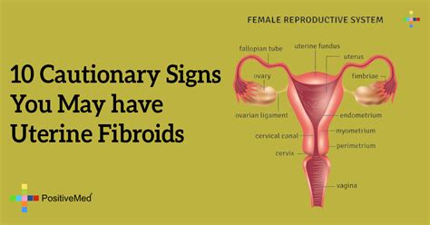 10 Cautionary Signs You May Have Uterine Fibroids