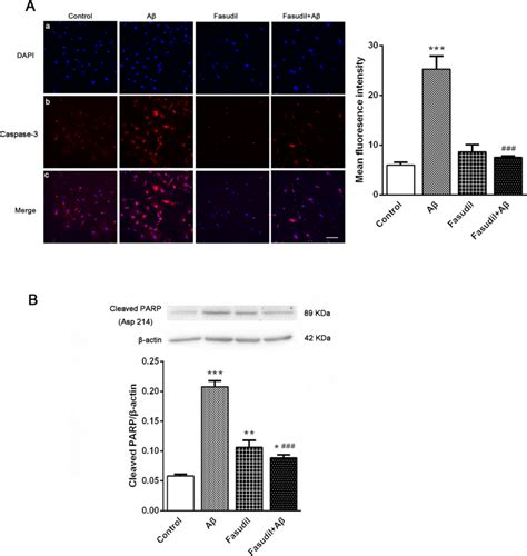 Expression Of Caspase 3 A And Cleaved PARP B In Primary Cultures Of