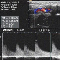 Guidelines For Noninvasive Vascular Laboratory Testing A Report Frorm