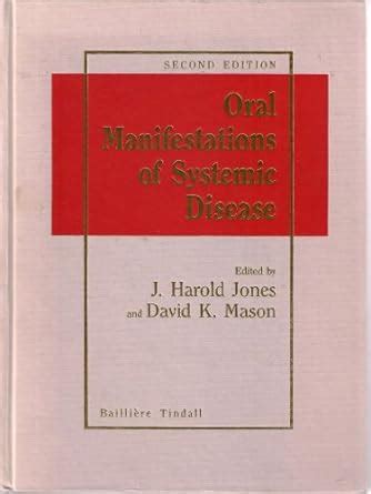 Buy Oral Manifestations Of Systemic Disease Book Online At Low Prices