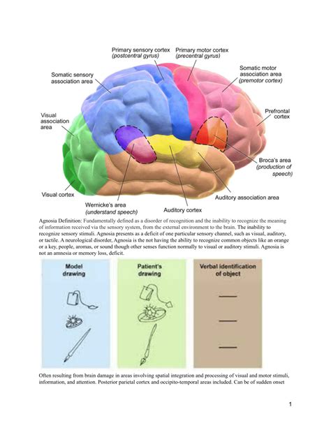 (PDF) Agnosia 2021