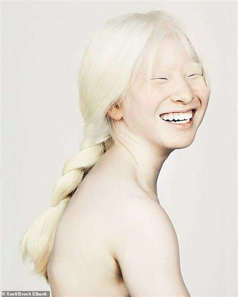 Albino model who was abandoned as a baby in China features in Vogue ...