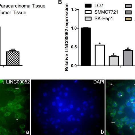 Analysis The Expression Of Linc00052 In Hcc Tissue And Hcc Cell Lines