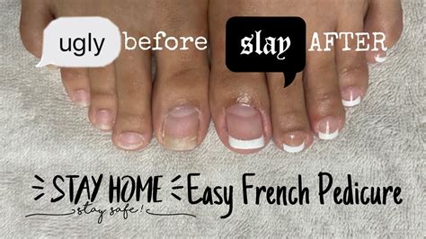 Easy French Pedicure At Home Nails Diy Nails Cheap Nails How To Nails Esther