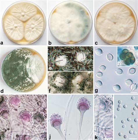 Aspergillus Udagawae Ccf Ac Colonies Incubated Days At C