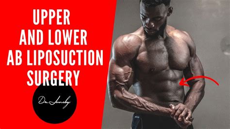 Live Surgery With Dr Jeneby Upper And Lower Ab Liposuction Surgery 2021 Youtube