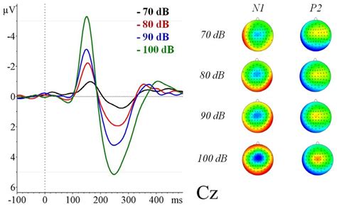 Grand Average N 16 Of The Auditory Evoked Related Potentials For