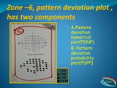 Humphrey Visual Field Analyser Hvfa Ppt