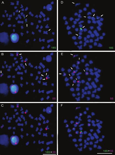 Fluorescence In Situ Hybridization With S Rdna A And D And S Rdna