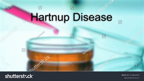 Hartnup Disease Hartnup Disease Text Medical Stock Photo 2150600939 | Shutterstock