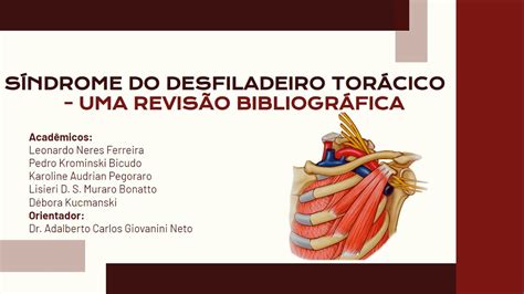 SÍNDROME DO DESFILADEIRO TORÁCICO UMA REVISÃO BIBLIOGRÁFICA YouTube