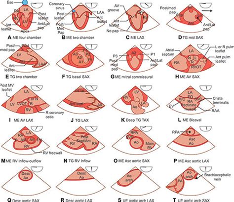 Transesophageal Echocardiogram Views