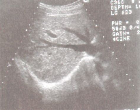 INTRO TO SONOGRAPHY II Diagram Quizlet