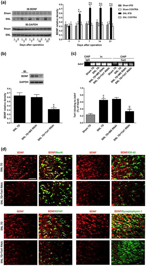 SNL Induction Of Spinal BDNF Expression And Tet1 Bdnf Promoter Binding