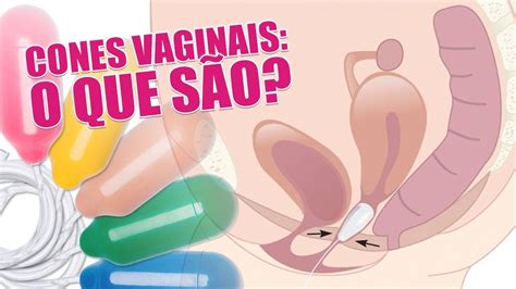 Cone Vaginal Para Que Servem Ajudam Na Di Stase Especialistas