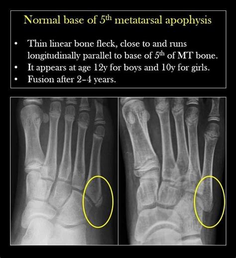 Pin By Priyanka On Medicine Medical Radiography Radiology Imaging Medical Ultrasound