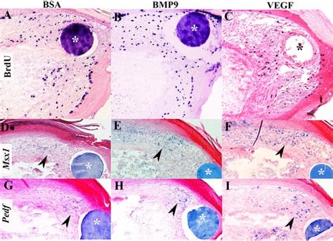 Blastema formation is not influenced by BMP9 or VEGF treatment. The ...