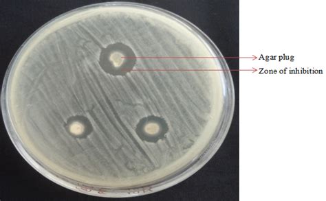 Antimicrobial Activity And Phytochemical Analysis Of Endophytic Fungal