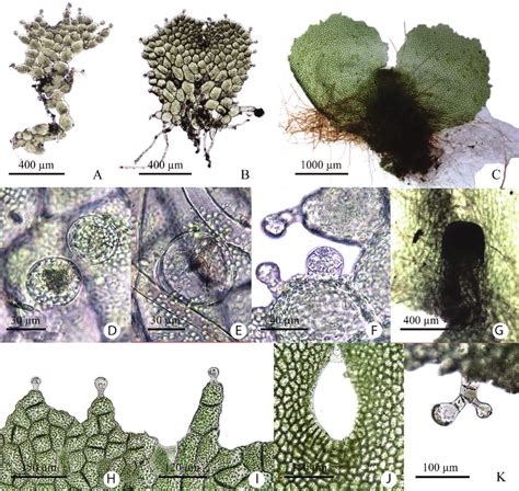 Prothallia And Sexual Organs Of Cyrtogonellum Inaequale Christ Ching Download Scientific