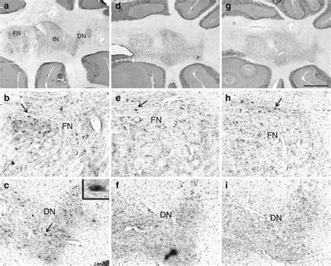 Representative Low Power Photomicrographs Of C Fos Expression In A Download Scientific Diagram