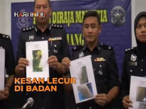 Fokus Hari Ini Malam Isu Tanah Felda Kesan Lecur Di Badan Video