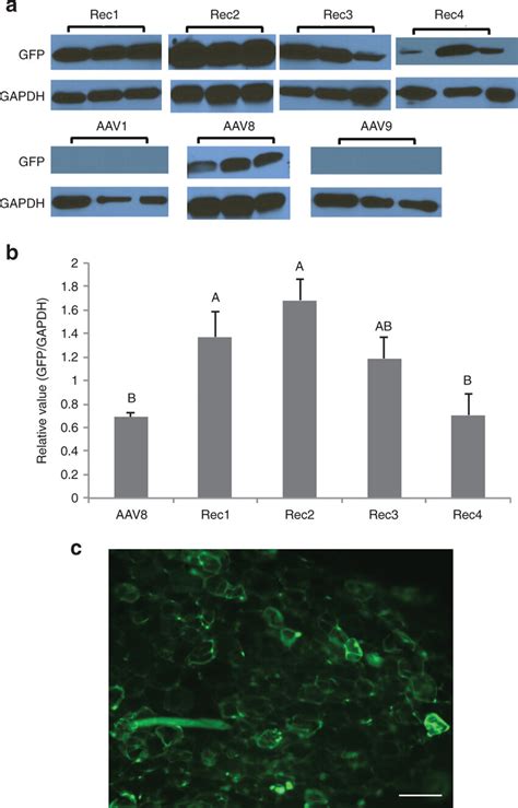 Quantification Of Transgene Expression Mediated By Seven Aav Serotypes