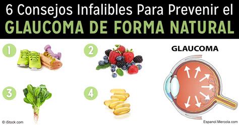 6 Consejos Infalibles Para Prevenir El Glaucoma De Forma Natural